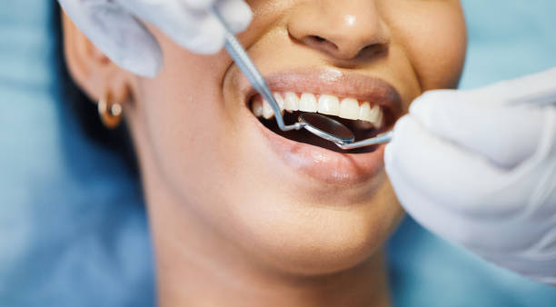 Best Emergency Dental Surgery in New California, OH