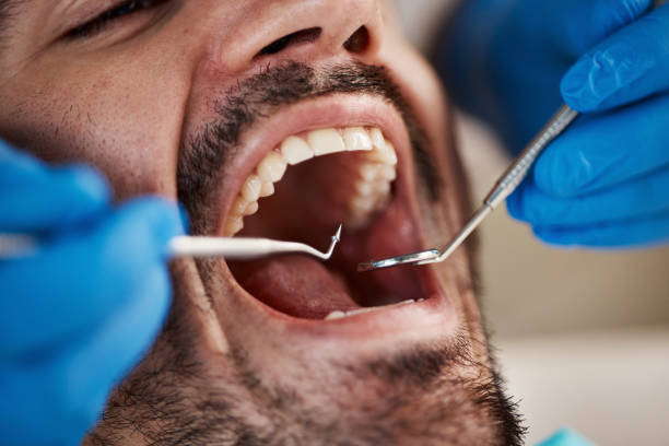 Best Emergency Treatment for Toothache in New California, OH